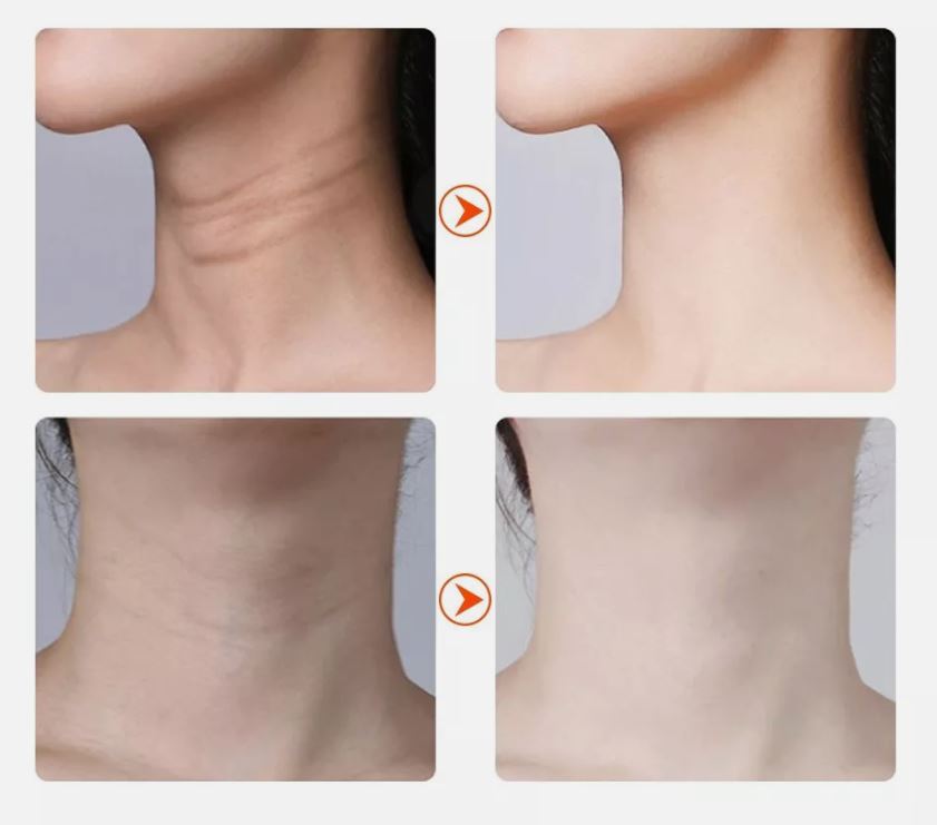 Lifteur facial tonifiant, anti-rides et anti age